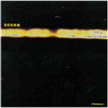 [ scorn - anamnesis ]